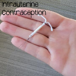 Intrauterine Contraceptive: Link to Information