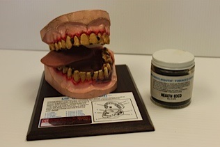 Mr. Gross Mouth Model of teeth, tongue, and oral cavity shows the effects of using smokeless tobacco
