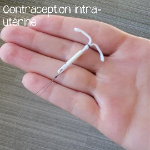 o Contraception intra-utérine (DIU ou stérilet) (IUS)
