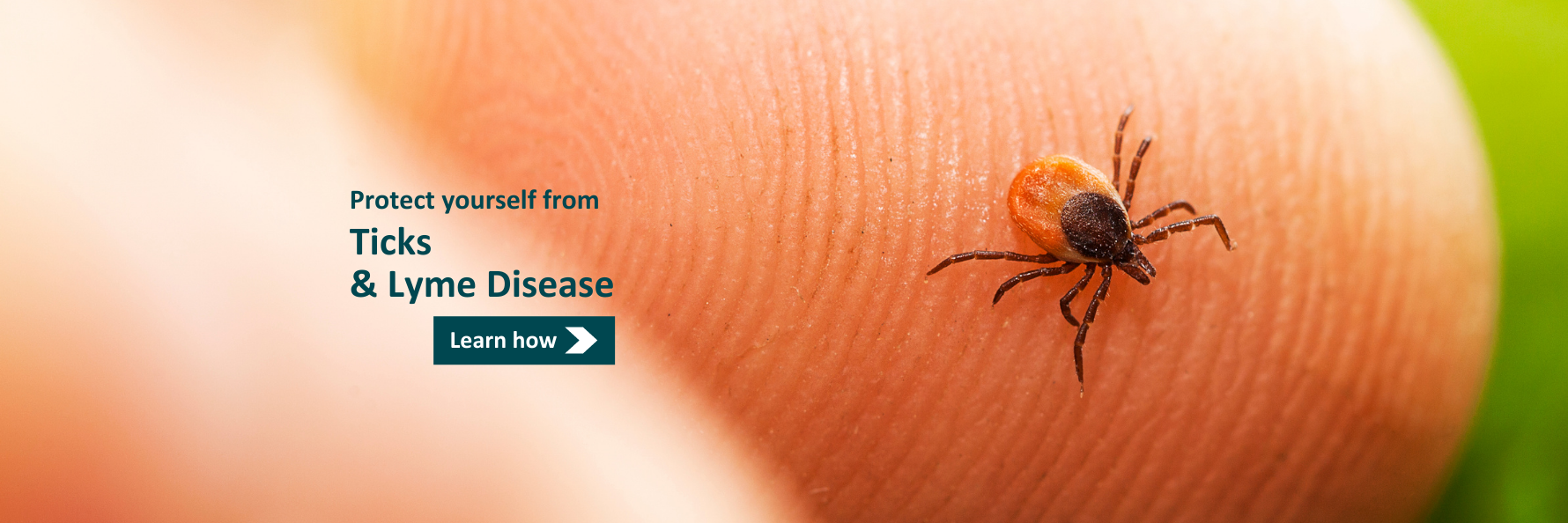 Close-up image of a tick on a fingertip. Text: Protect yourself from Ticks and Lyme Disease. Learn how. 