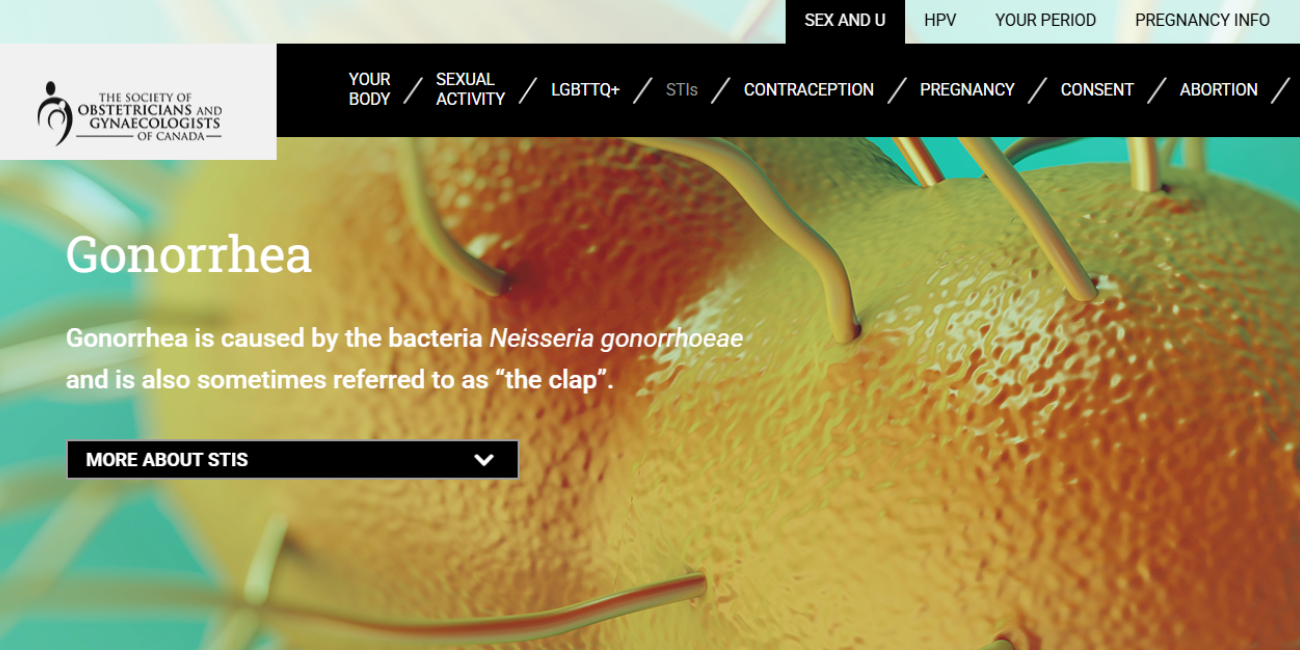 Screenshot of the sexandu.ca gonorrhea webpage, webpage text reads "Gonorrhea is caused by the bacteria Neisseria gonorrhoeae and is also sometimes referred to as 'the clap'"