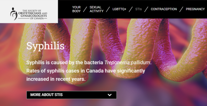 Screenshot of the sexandu.ca syphilis webpage, webpage text reads "Syphilis is caused by the bacteria Treponema pallidum. Rates of syphilis cases in Canada have significantly increased in recent years."