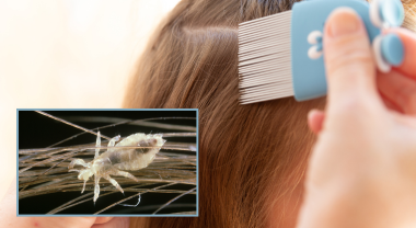 Image of a child's hair being combed by adult hands, with an overlapping, magnified image of an insect in the hair.
