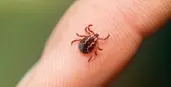 Close-up image of a tick on a finger. 