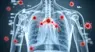 This image shows parts inside the body and several virus molecules outside the body,  illustrating a respiatory virus