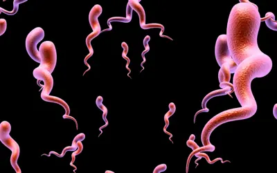 Syphilis